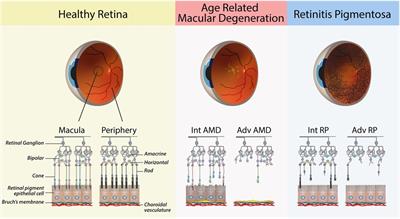 A treatment within sight: challenges in the development of stem cell-derived photoreceptor therapies for retinal degenerative diseases
